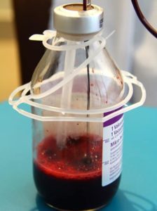 Autohemotherapy - blood being ozonated in glass bottle - image courtesy of Bali Ozone Therapy