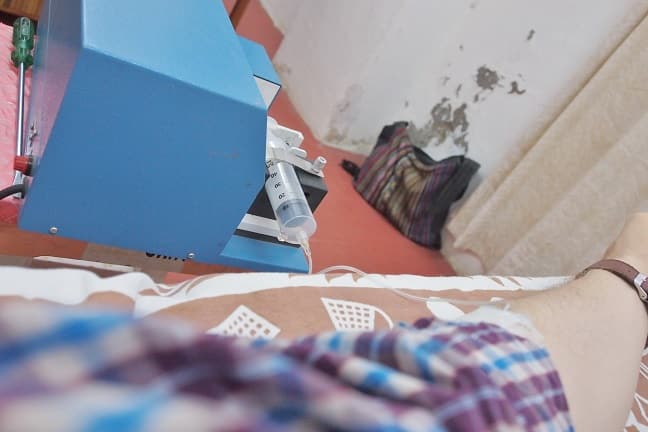 Me receiving DIV ozone therapy close up